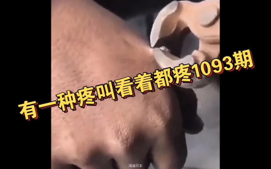 有一种疼叫看着都疼1093期-1.jpg