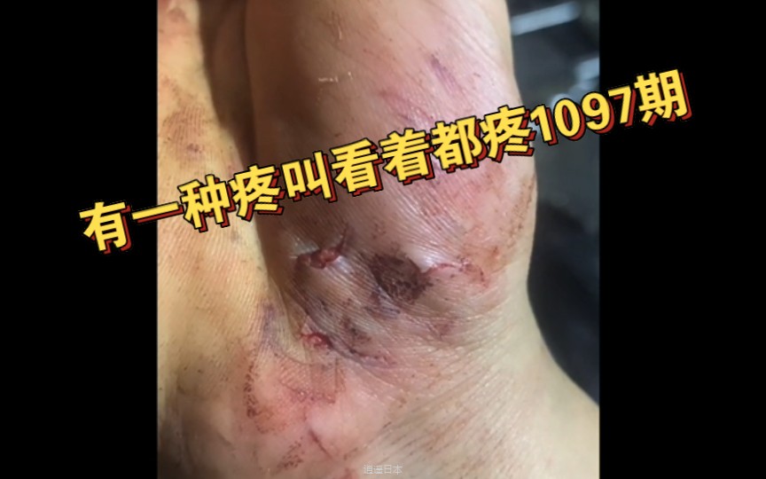 有一种疼叫看着都疼1097期-1.jpg